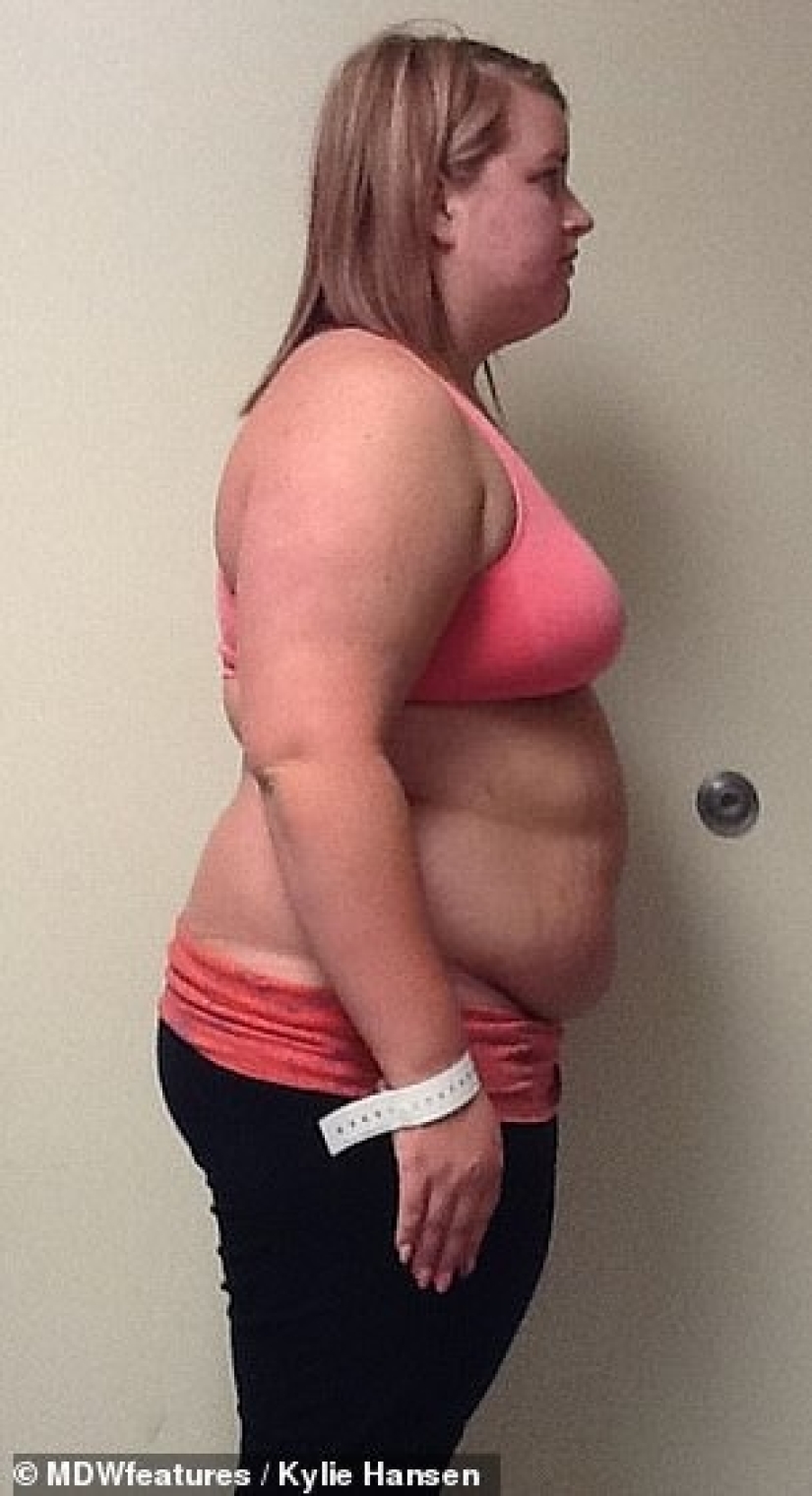 From extreme to extreme: a woman lost 50 kg, but could not stop there From extreme to extreme: a woman lost 50 kg, but could not stop there