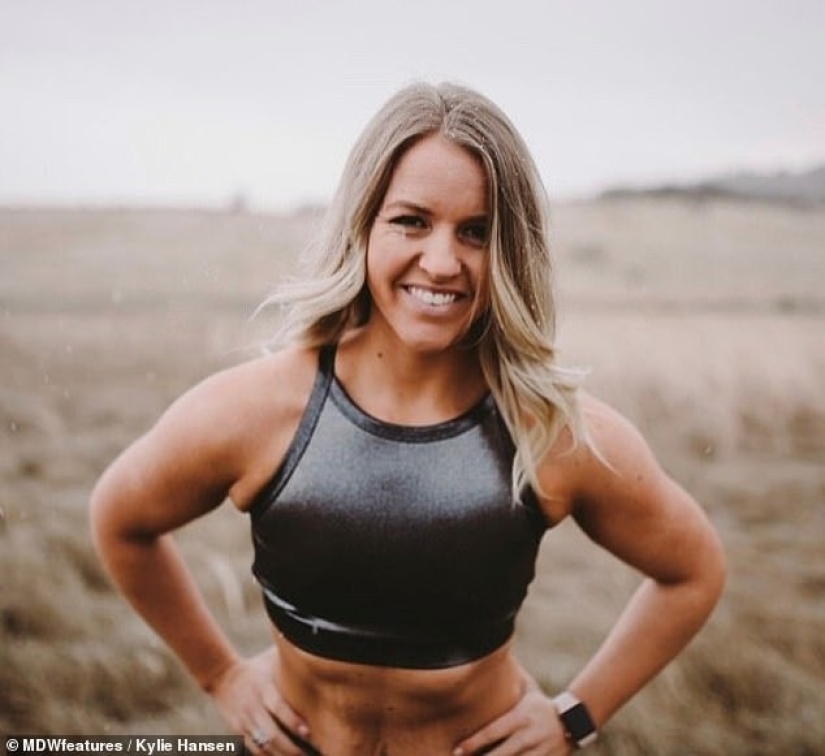 From extreme to extreme: a woman lost 50 kg, but could not stop there From extreme to extreme: a woman lost 50 kg, but could not stop there