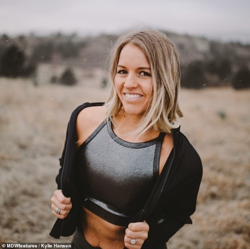 From extreme to extreme: a woman lost 50 kg, but could not stop there From extreme to extreme: a woman lost 50 kg, but could not stop there