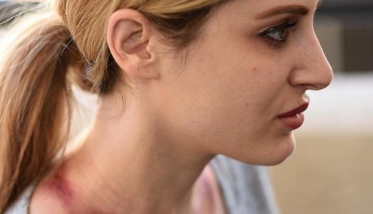 "Giraffe Woman": an American woman stretched her neck for 5 years to become like a giraffe