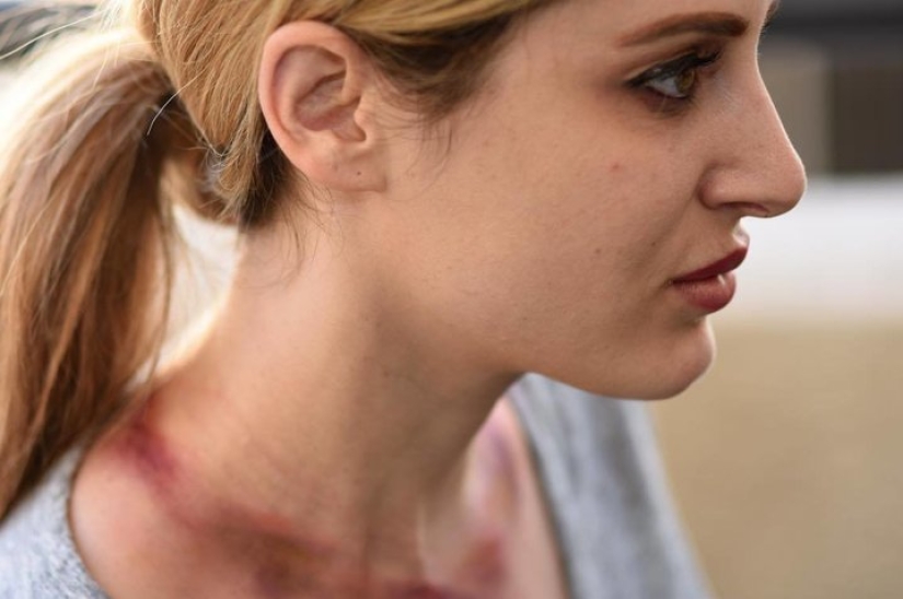 "Giraffe Woman": an American woman stretched her neck for 5 years to become like a giraffe