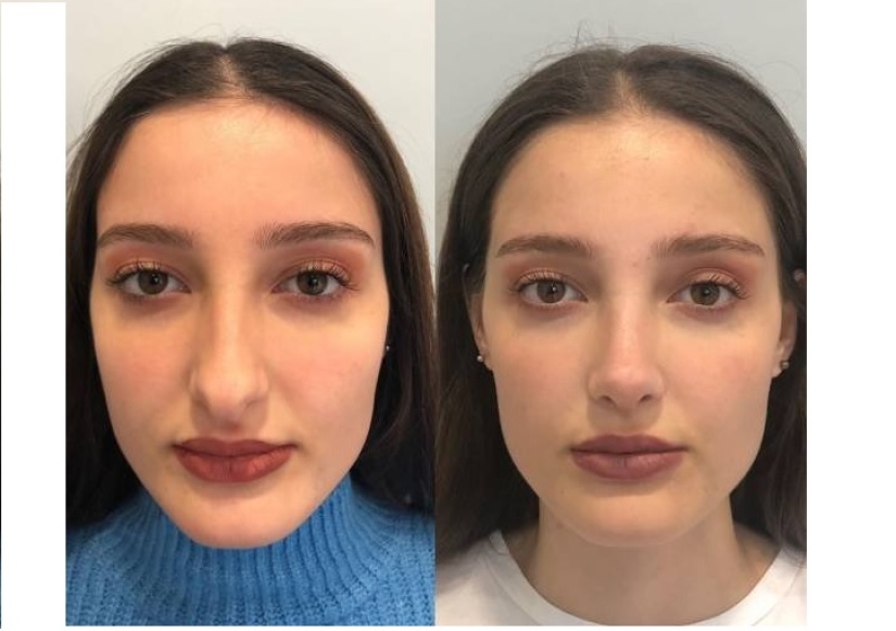 Girls before and after just one change in appearance Girls before and after just one change in appearance
