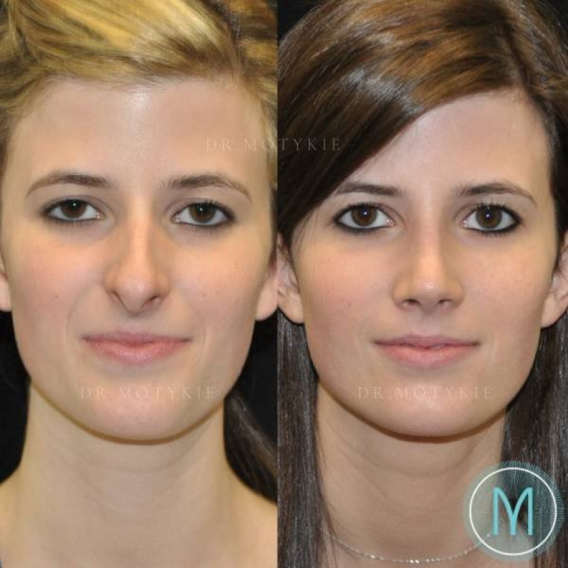 Girls before and after just one change in appearance Girls before and after just one change in appearance