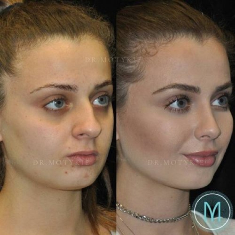 Girls before and after just one change in appearance Girls before and after just one change in appearance
