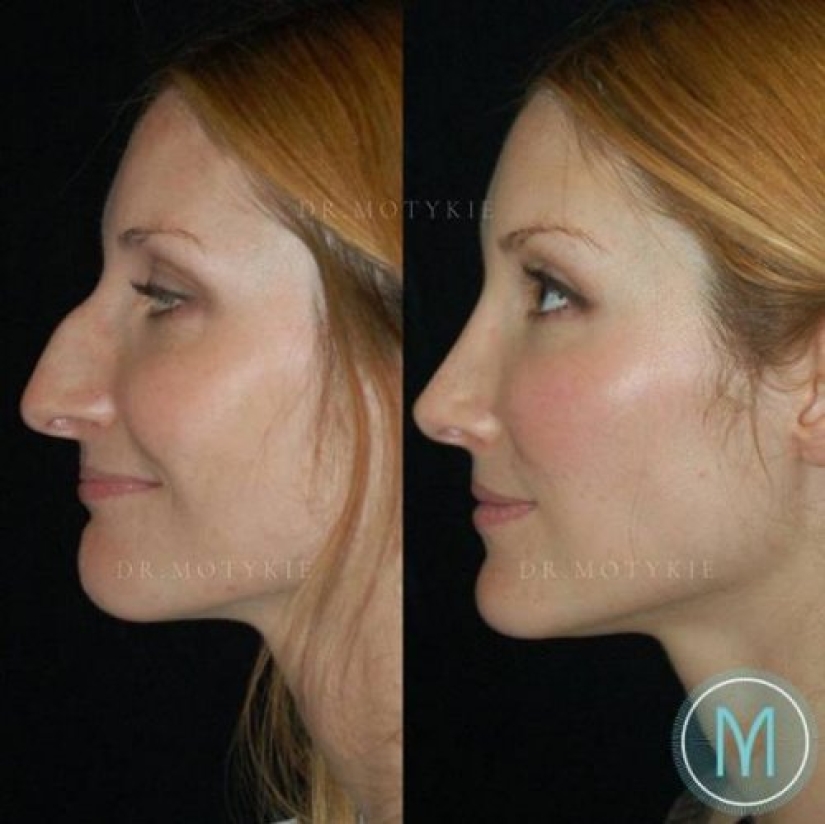 Girls before and after just one change in appearance Girls before and after just one change in appearance