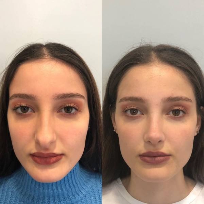 Girls before and after just one change in appearance Girls before and after just one change in appearance