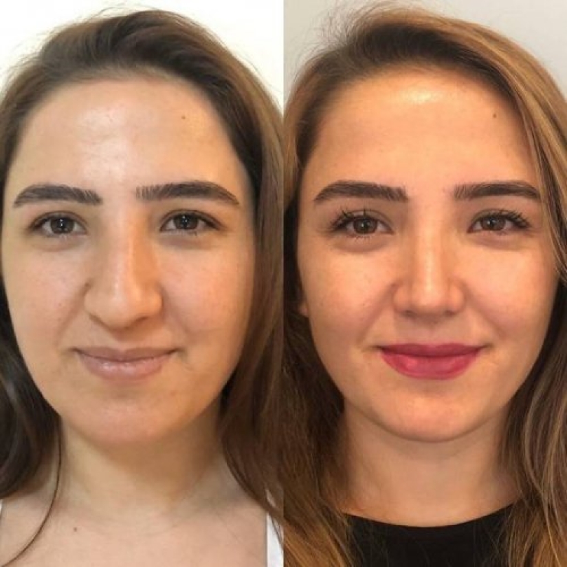 Girls before and after just one change in appearance Girls before and after just one change in appearance