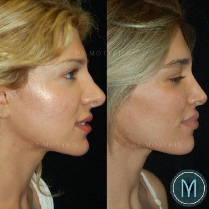 Girls before and after just one change in appearance Girls before and after just one change in appearance