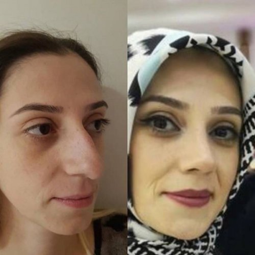 Girls before and after just one change in appearance Girls before and after just one change in appearance