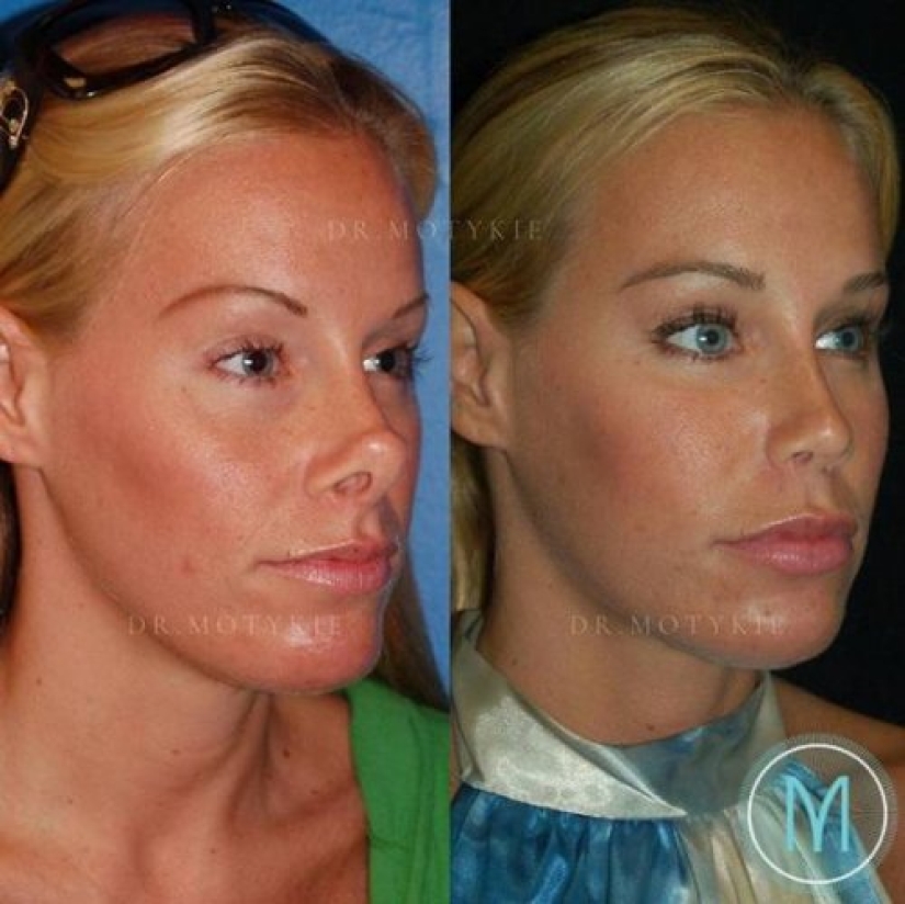 Girls before and after just one change in appearance Girls before and after just one change in appearance