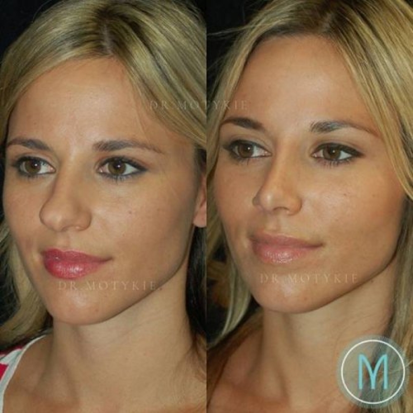 Girls before and after just one change in appearance Girls before and after just one change in appearance