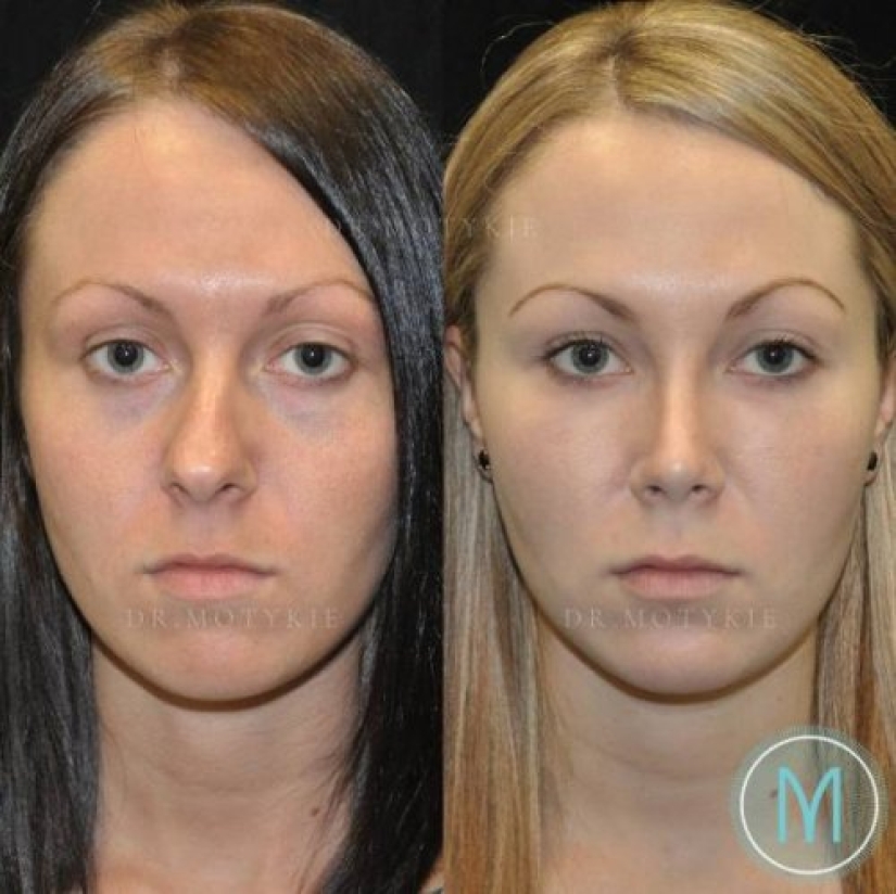 Girls before and after just one change in appearance Girls before and after just one change in appearance