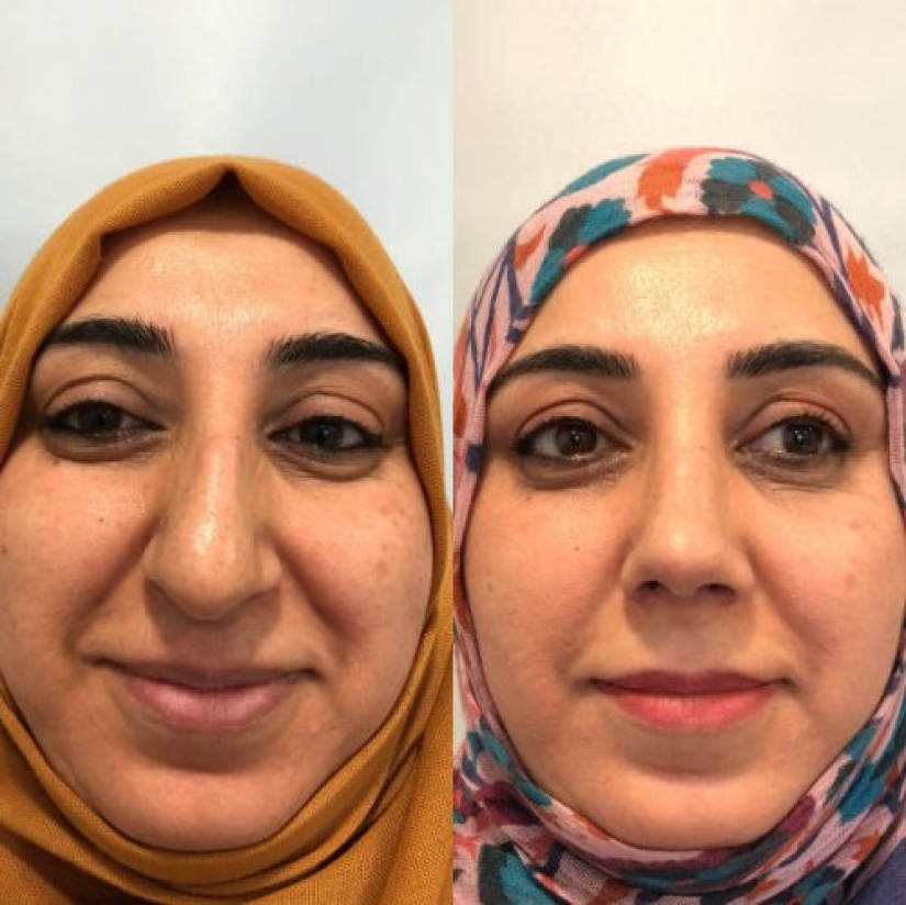 Girls before and after just one change in appearance Girls before and after just one change in appearance