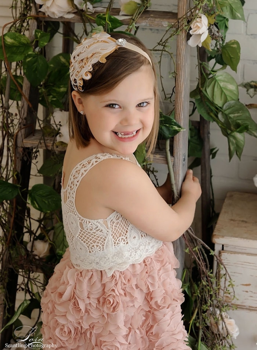 Habiendo derrotado al cáncer, las chicas repitieron la sesión de fotos tomada al comienzo del viaje