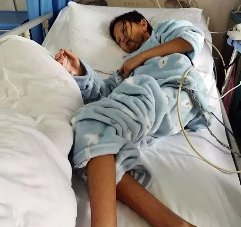 Hambrienta por salvar a su hermano: una estudiante que había estado comiendo arroz durante cinco años murió en China