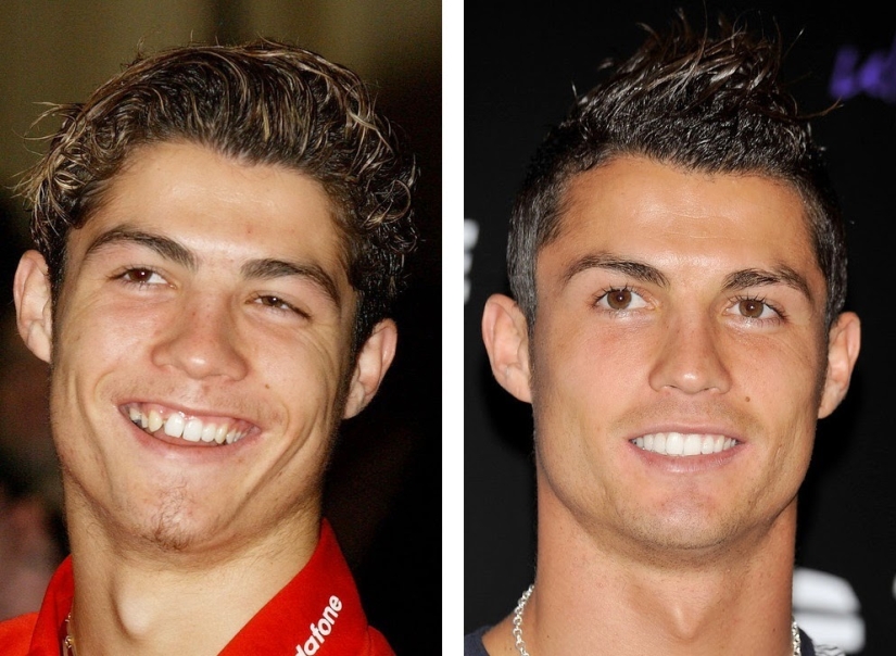 Here's how radically braces change a smile and life