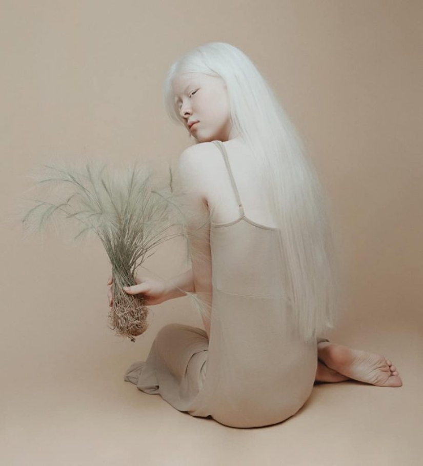 Hermanas albinas de Kazajstán conquistan el mundo del modelaje Hermanas albinas de Kazajstán conquistan el mundo del modelaje