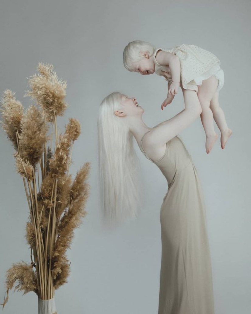 Hermanas albinas de Kazajstán conquistan el mundo del modelaje Hermanas albinas de Kazajstán conquistan el mundo del modelaje