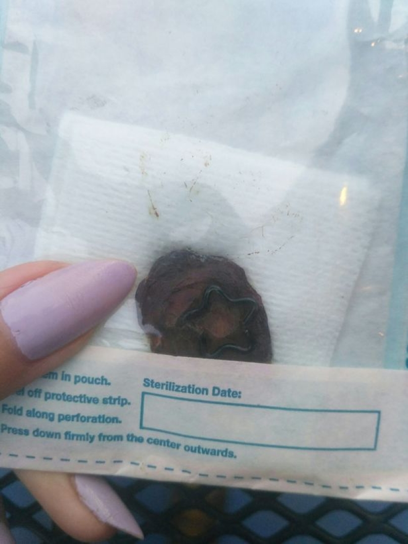 "Honey, this is for you": A 23-year-old girl removed her navel and gave it to her boyfriend "Honey, this is for you": A 23-year-old girl removed her navel and gave it to her boyfriend