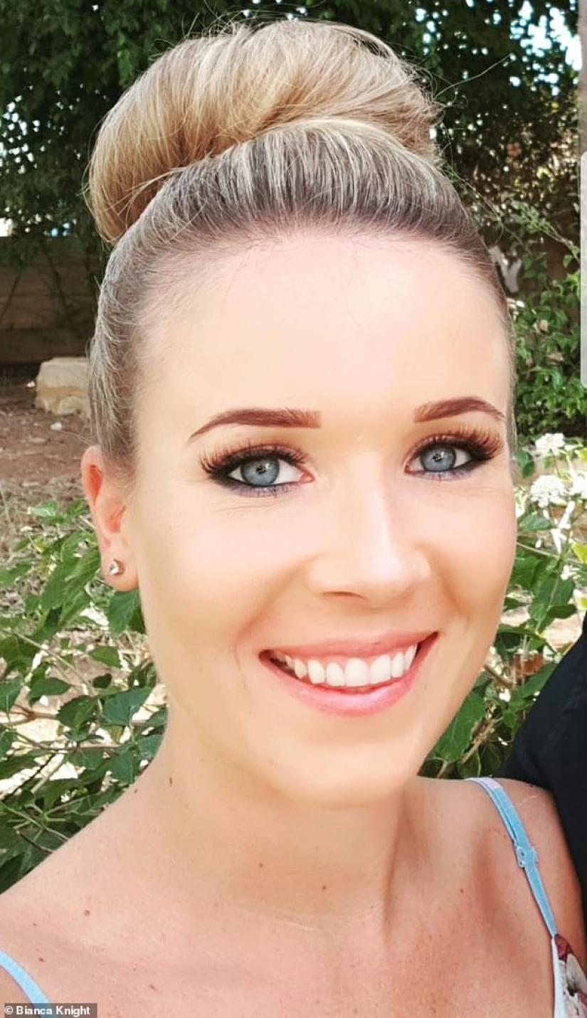 How a phone and a computer age the skin: a young woman was horrified by the effects of radiation on her face