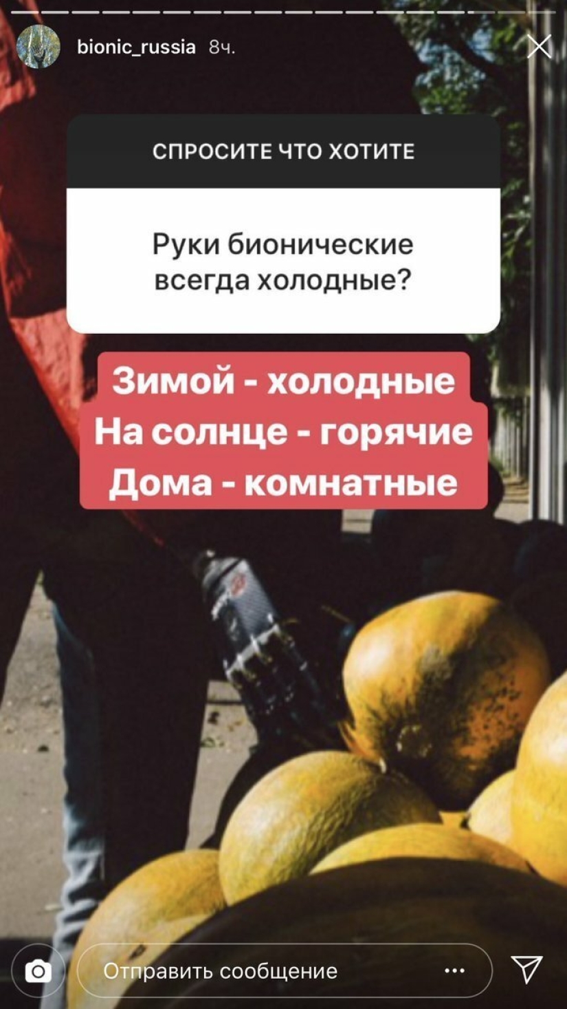 How cyborg Kostya lives: revelations of a guy without hands