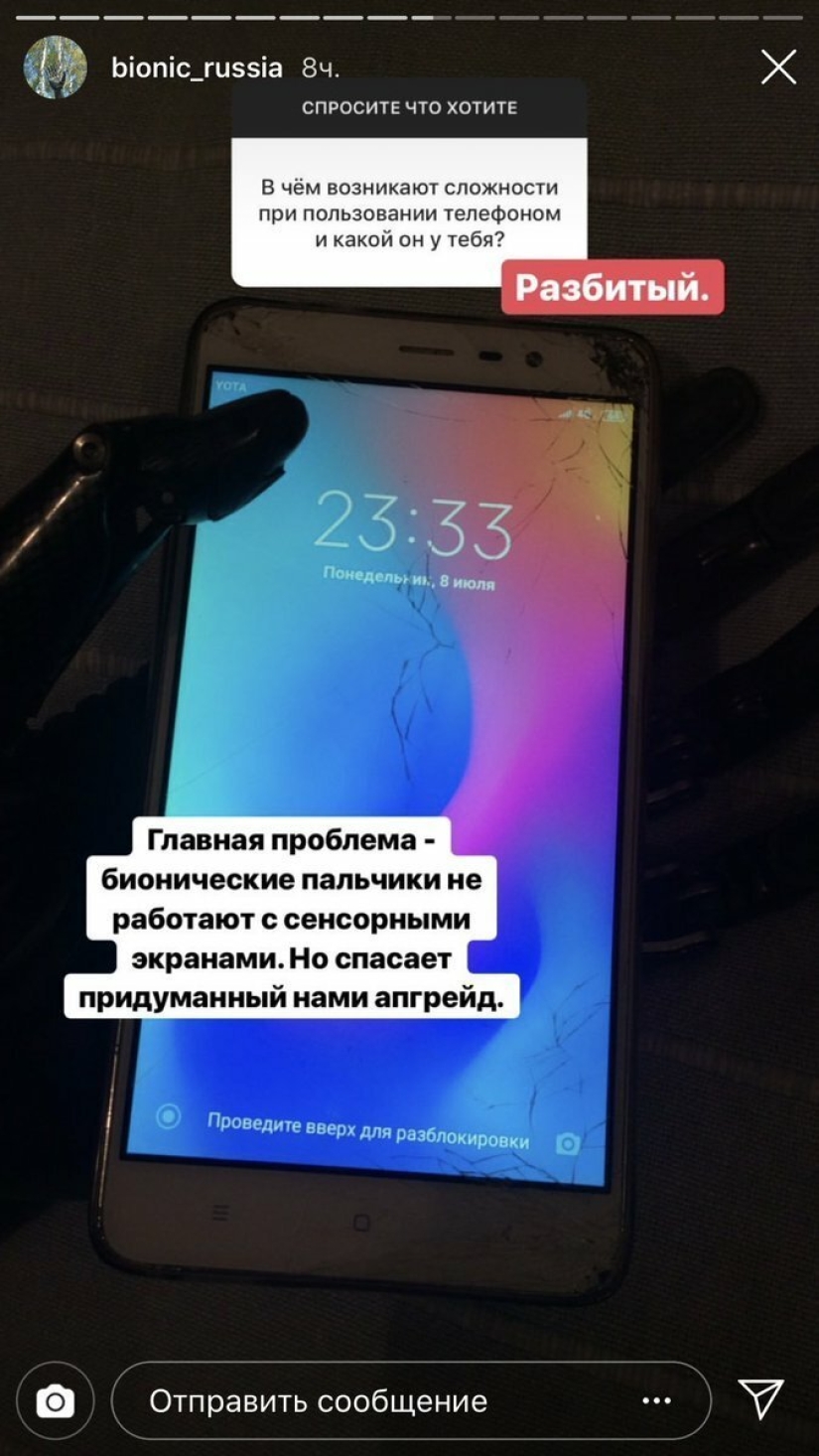 How cyborg Kostya lives: revelations of a guy without hands