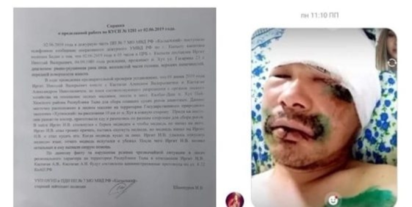 How harsh Siberians are: a resident of Tyva fought off a bear by biting off his tongue