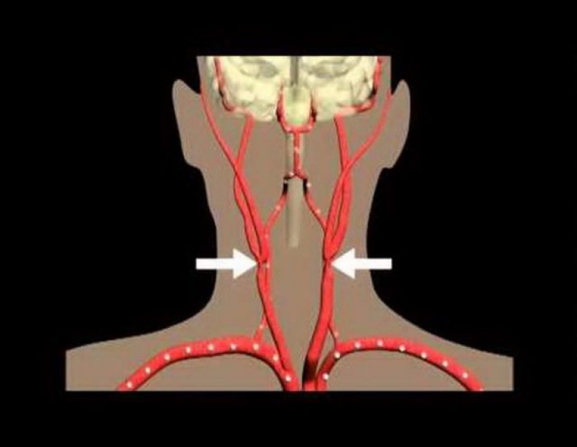 How to get rid of pain in ancient times