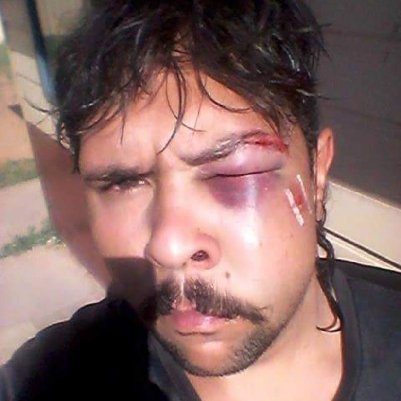 In Australia, a kangaroo knocked out a hunter by breaking his jaw In Australia, a kangaroo knocked out a hunter by breaking his jaw