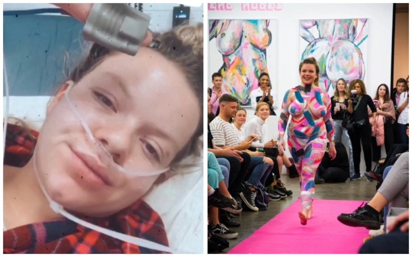 Insight one step before death: how the disease gave the girl self-confidence and love for her own body