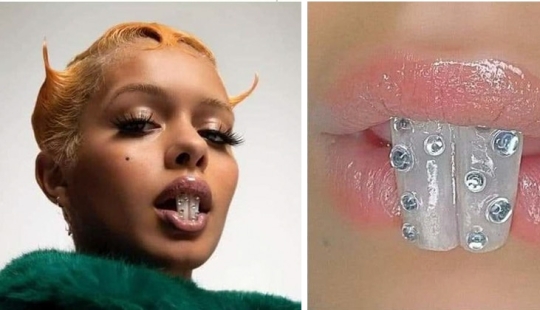 Is it fashionable? I give you a tooth! How outrageous fashion crept into dentistry