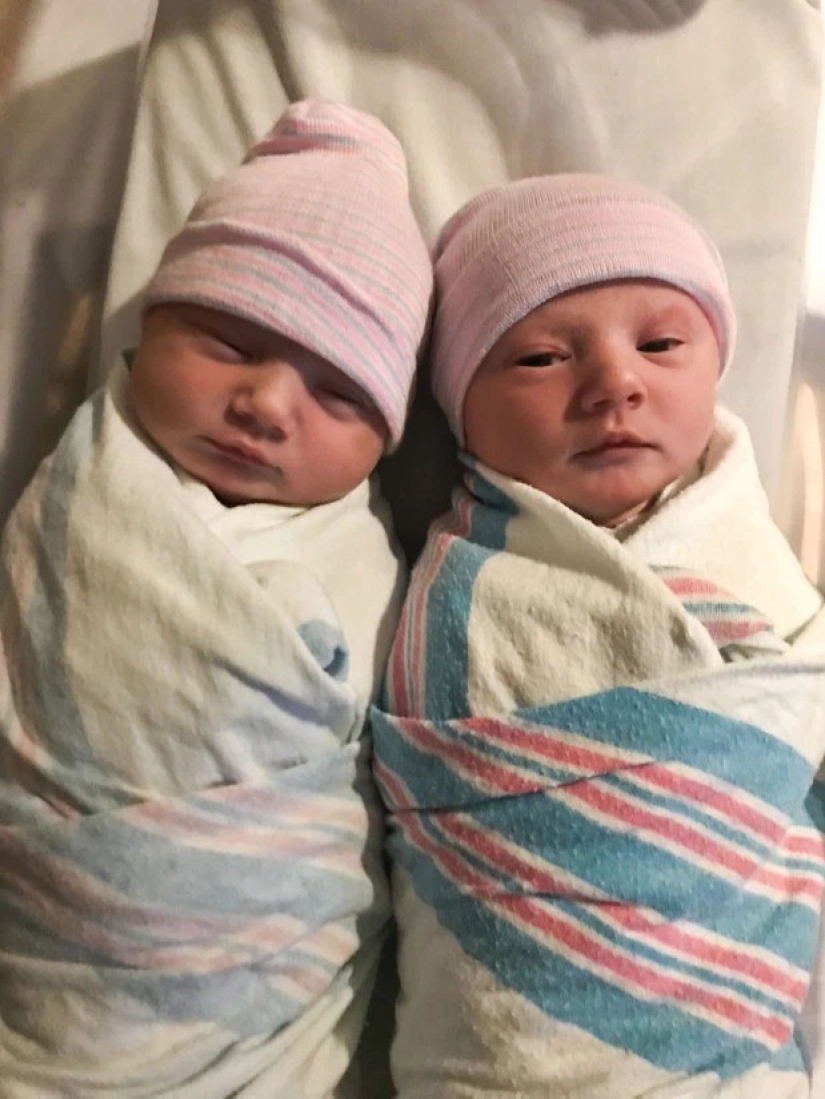 Kinder surprise: a young mother was shocked when she gave birth to twins instead of one daughter