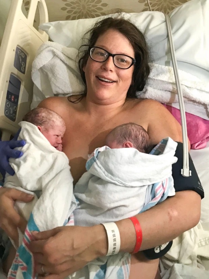 Kinder surprise: a young mother was shocked when she gave birth to twins instead of one daughter