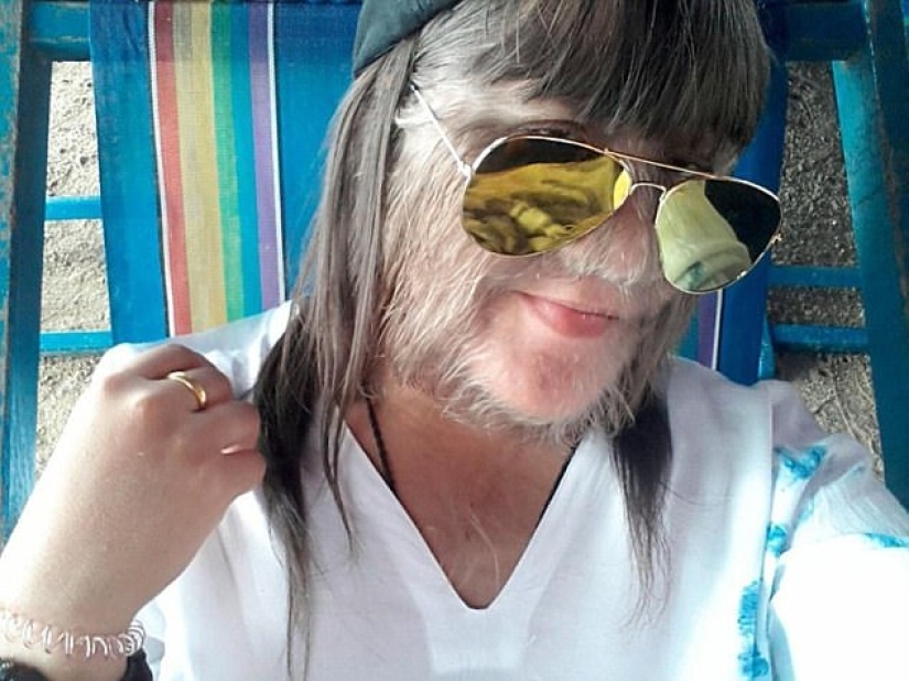 "La chica más peluda del mundo" se casó y comenzó a afeitarse la cara "La chica más peluda del mundo" se casó y comenzó a afeitarse la cara