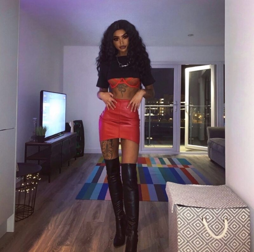La chica, obsesionada con el bronceado, se convirtió en una de piel oscura. Todo gracias al solarium y las inyecciones