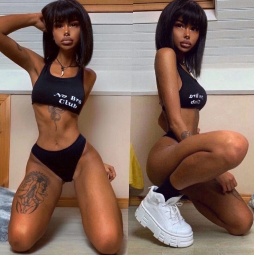 La chica, obsesionada con el bronceado, se convirtió en una de piel oscura. Todo gracias al solarium y las inyecciones