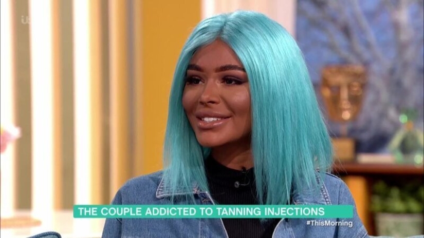 La chica, obsesionada con el bronceado, se convirtió en una de piel oscura. Todo gracias al solarium y las inyecciones