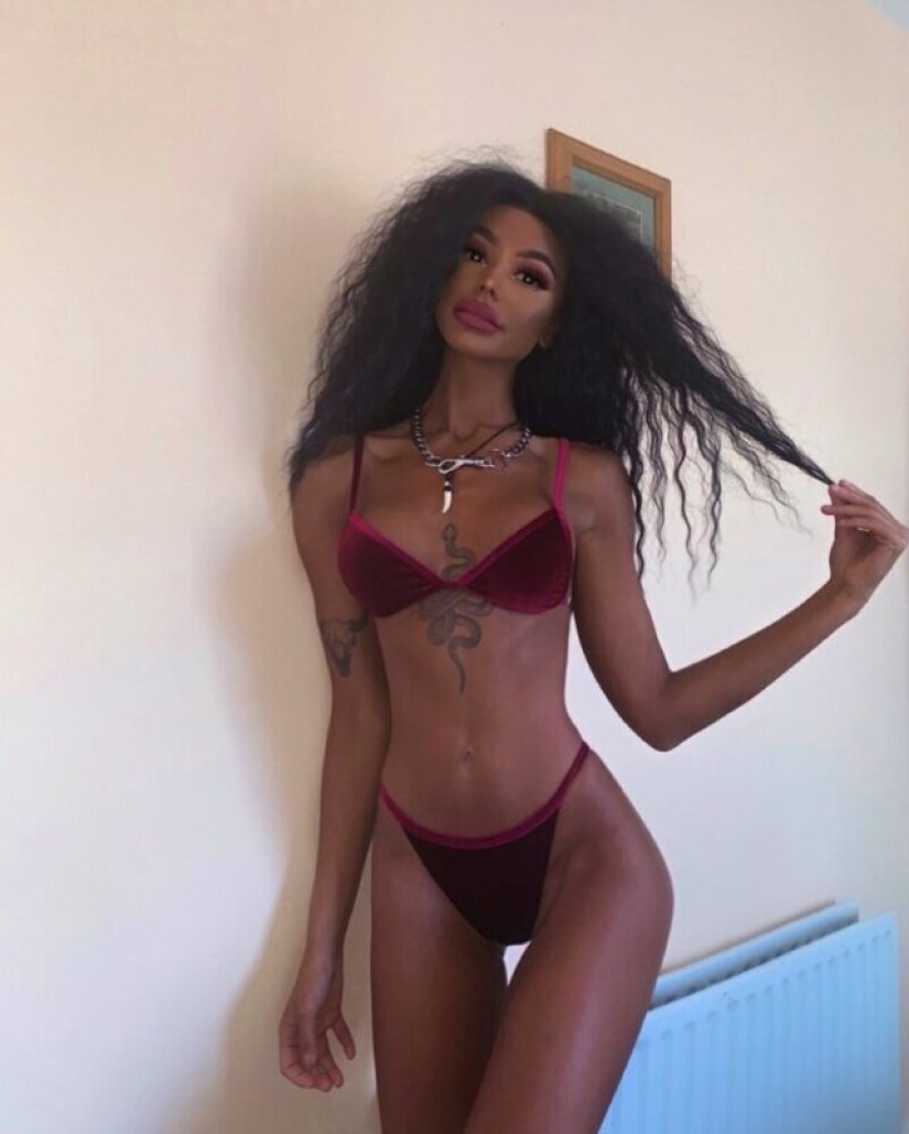 La chica, obsesionada con el bronceado, se convirtió en una de piel oscura. Todo gracias al solarium y las inyecciones