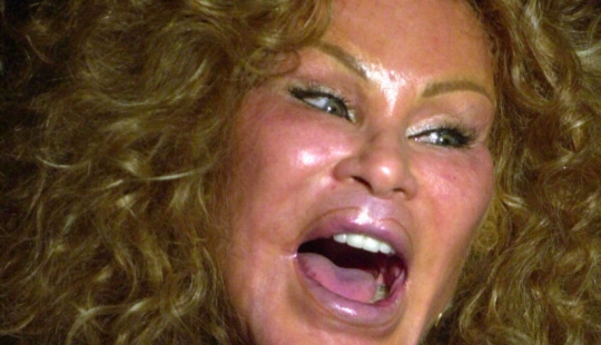 La loca vida de la multimillonaria Jocelyn Wildenstein, conocida como "Catwoman" La loca vida de la multimillonaria Jocelyn Wildenstein, conocida como "Catwoman"