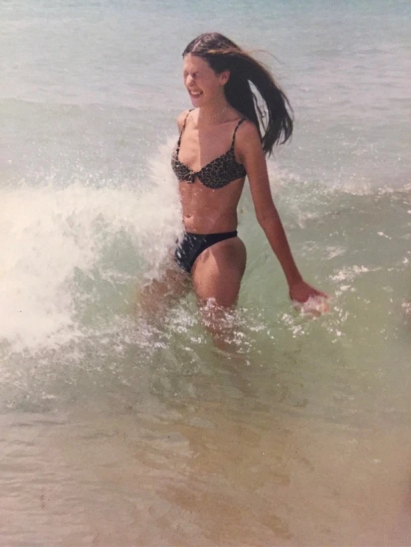 La mejor versión de sí misma: una mujer hizo un pecho de talla 8 para lograr la perfección