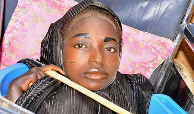 La niña de la cuenca: la historia de una mujer nigeriana con la cabeza de una mujer adulta y el cuerpo de un bebé