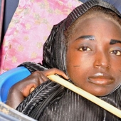 La niña de la cuenca: la historia de una mujer nigeriana con la cabeza de una mujer adulta y el cuerpo de un bebé