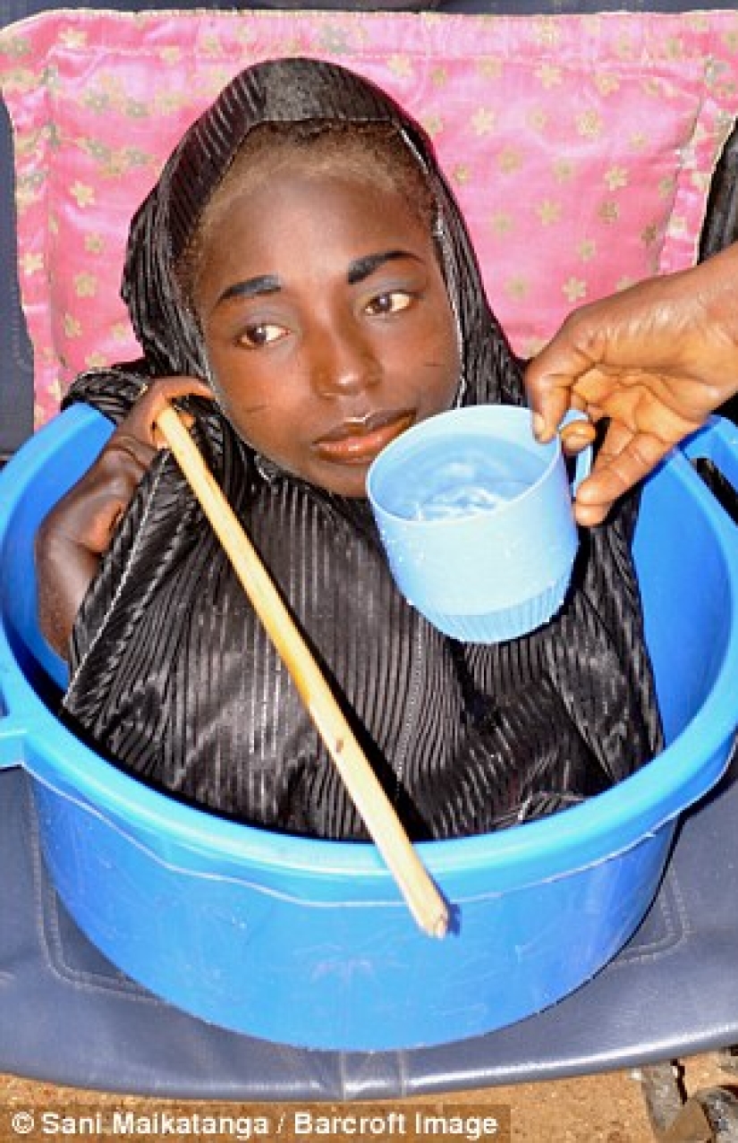 La niña de la cuenca: la historia de una mujer nigeriana con la cabeza de una mujer adulta y el cuerpo de un bebé