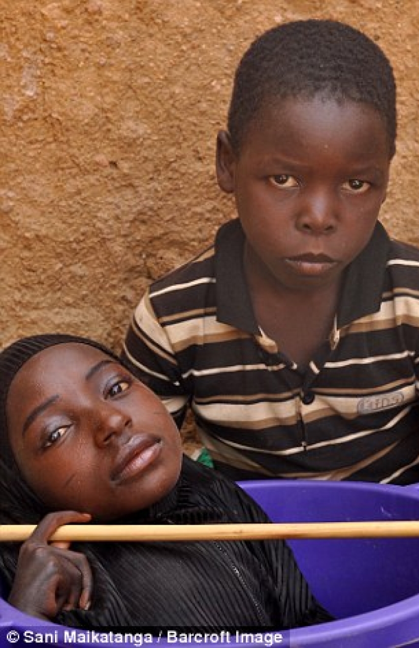 La niña de la cuenca: la historia de una mujer nigeriana con la cabeza de una mujer adulta y el cuerpo de un bebé