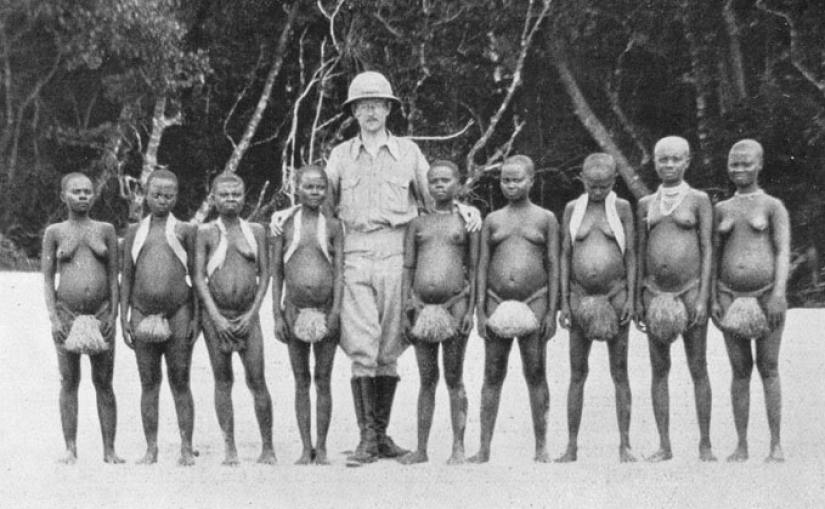 La trágica vida y muerte del pigmeo Ota Benga, una exhibición viva del zoológico