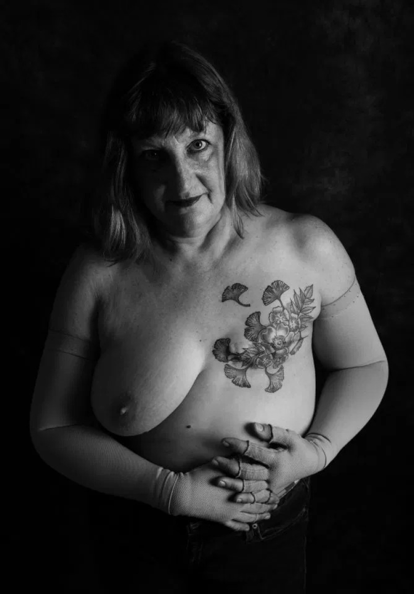 La verdad desnuda: Pacientes valientes se enfrentan al cáncer mostrando cicatrices en el conmovedor proyecto fotográfico de Ami Barwell