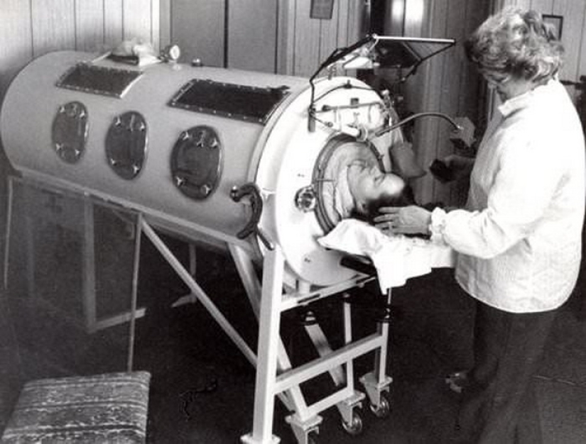 Life in the "tank": a woman spent almost 60 years in a ventilator