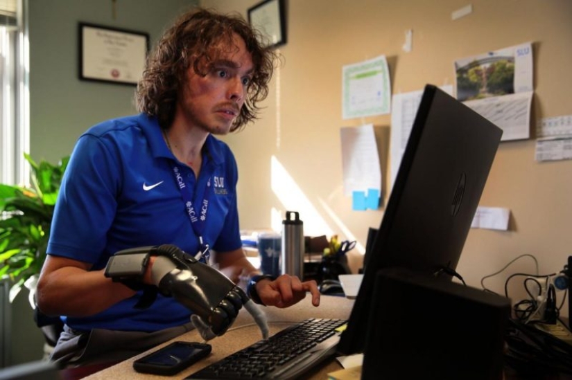 Los ataques de animales más famosos a humanos