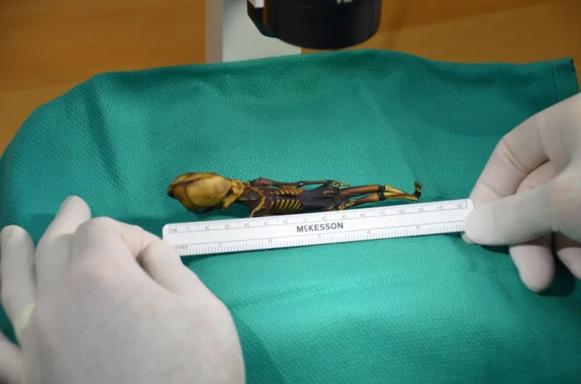 Los científicos han recreado la apariencia de un Cromañón, cuya cara está cubierta de tumores