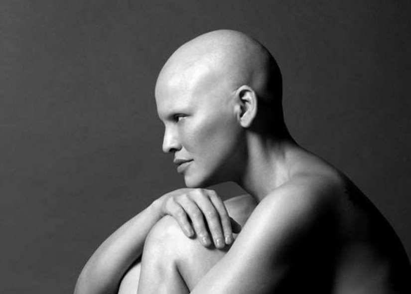 Model Mieko Rai: "I have stage three breast cancer and I have never felt more beautiful"